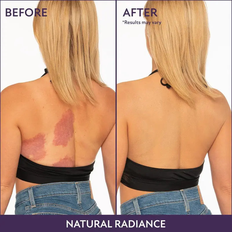 🔥🔥Buy 1, Get 1 Free🔥Beauty Body Coverage